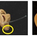 광교보청기 이미지