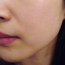 The 예쁜 피부 이미지