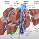 8cm 크기 간암 환자의 통합의학적 치료 결과 보고서 이미지