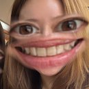 세란빛치과의원 | 신사 | 레브치과 원데이 미백 내돈내산 후기 - 치아사진 많음 주의!