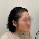 손혜진헤어 | 하남 미사 헤어라인 정수리 가르마 탈모커버 전문 두피문신 지니도트에서 부작용 없이 깔끔하게