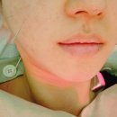 전진 한의원 | 얼굴비대칭치료 잘하는곳 강남 안면비대칭병원 추천 내돈내산 후기