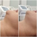 미더베스트마곡점 | 마곡피부관리 마곡리프팅 트러블 꼼꼼한 관리 예신관리 미더베스트마곡점