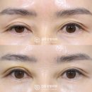 디비성형외과의원 이미지