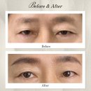 드라마시티 | 수원 눈썹문신 피씨엘 코리아 내돈내산 후기 부모님 대만족