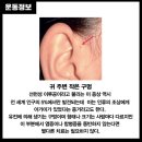 누벌바그(주)미리개발 | 선천성이루공 수술 받은 이야기(2년 전 수술과 최근 근황)