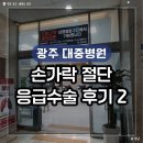 [공지] 광주 대중병원 정형외과 손가락 절단 수술 후기 2