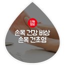 나이 불문! 손목 건초염 이미지