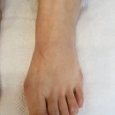 레푸스&비욘드네일