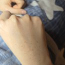 (주)바디채널 여의도 | 여의도 여드름 압출 맛집.. 강추