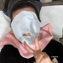 강남 여드름자국 개선 3회차 엠톤 관리 후기
