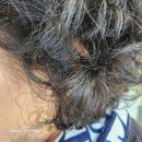 대동 독일보청기 이미지