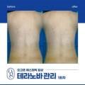 오고픈에스테틱