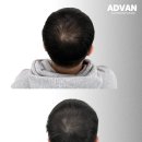 어드반SMP 이미지