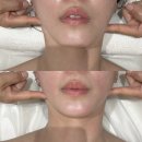 얼굴비대칭 관리, 목동체형교정 모비연 후기
