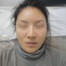(주)메디플라머터리얼스 | 반월당 피부관리 수분 재생 에스테틱 데자뷰메디스킨 대구점