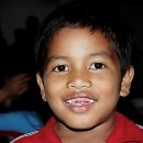 웰컴치과의원 | 입이 근질거려서 말해버릴 뻔했던 치과 썰 푼다