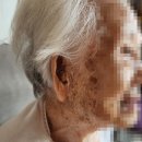 시그니아 보청기 원주점 | 96세 어머님 출장/방문 보청기 착용 후기!