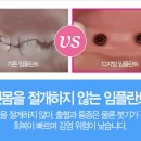 프라임치과기공소 이미지