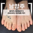 올바른의원 | 올바른 손발톱 클리닉(EM365) 러닝 후 피멍에서 시작된 통증 [남양주 내성발톱 치료 후기]