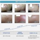 최희정한의원 | [일산피부과] 친절하기로 소문난 규림한의원 치료후기 !!