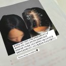 4459 | 세종 세종시 두피문신 20·30대 여성들이 요즘 가장 많이 찾는 시술 ‘이것’