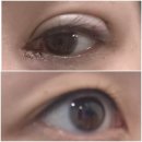 연도약국 | 비절개 쌍커플 눈매교정 윗트임 1일차~2주차 내돈내산 후기