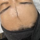 선명이용원 | 스킨플래닝 콤마뷰티에서 윤광피부된 솔직후기 (주의사항 , 부작용)