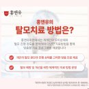 서림동-S2 | 서림동여성탈모 치료, 섬세한 머리결이 빠지기 시작한다면