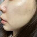 예뻐지샵