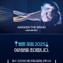 벨톤보청기 이미지