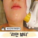 부산진구-38 | 부산진역피부관리 '리안뷰티' 이중턱 윤곽관리 후기