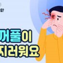 "눈이 간지러워서 자꾸 비비고 긁어요"...눈 가려움의 다양한 원인 이미지