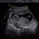 아름제일여성병원 이미지