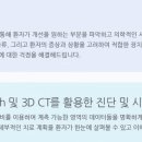 미소가있는치과의원 네이버블로그