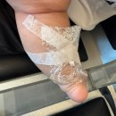 이석종피부과의원 | 실제 사진 있음⚡50일 아기 혈관종 치료, 이석종 피부과 후기