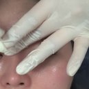 마이 메디칼 | 부천 피부맞춤케어 마이디어뷰티 홍조피부 관리 후기