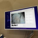 송도 | [인천 두피관리] 모바이오 송도점 후기