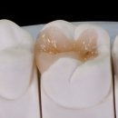 본치과기공소 이미지