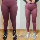 부산서면지방흡입 허벅지지흡 한달 솔직후기 후관리 몸무게 둘레 일상