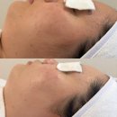 썸모어 뷰티 살롱 | 경기도 일산 스킨플래닝 잘하는곳은 썸모어뷰티살롱