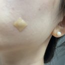 영통메이퓨어의원 | 영통피부과 점빼기 개당500원 CO2레이저 가격 및 후기