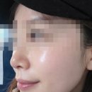 금오15길 | 양산피부관리 동면피부관리샵 끌림피부샵 MTS 관리 솔직리뷰