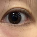 함안굿스마일치과의원 | 비앤빛안과 스마일라식 내돈내산 후기