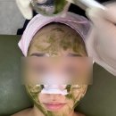 새솔동 피부관리 더샵끌림 트러블피부 플라즈마 후기