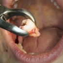 두류사랑니치과의원 이미지