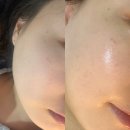 석정2길 | [안성 아리스민뷰티] 폰디먼트 피부관리 받고 만족한 후기 (소요시간, 관리과정 상세리뷰)