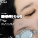늘푸른약국 | [서울 강동구 / 눈썹 잔흔제거] 미작뷰티 강동점