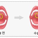 법인두그린 이미지