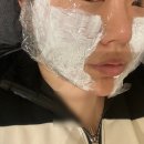 포르테의원 | 동탄 피부과 실리프팅 엘라스티 포르테픽스 PDO 비포애프터 후기 !!